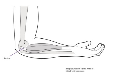 Golfers_elbow_location.jpg