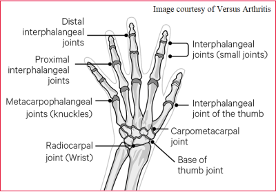 Hand Wrist Pain Joints.png