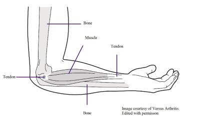 Elbow diagram