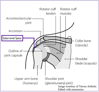 Drawing of the shoulder labelling the location of various soft tissues and bones. Highlighted is the sub acromial space.