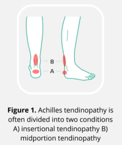 Achilles_Tendinopathy_Locations.png