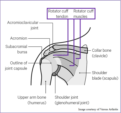 Drawing of the shoulder labelling the location of various soft tissues and bones. The location of the rotator cuff is highlighted.